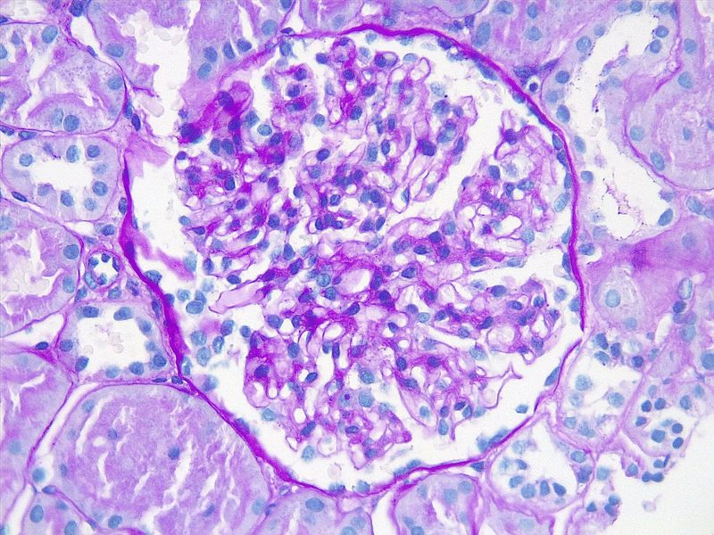 Glomérulo renal, tinción PAS