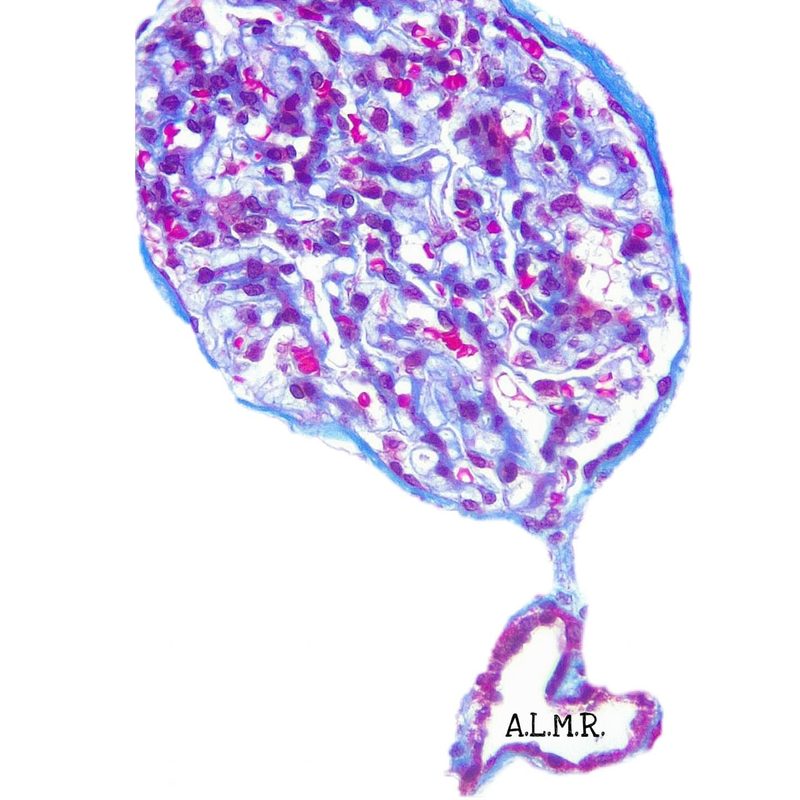 Glomérulo renal, tinción PAS